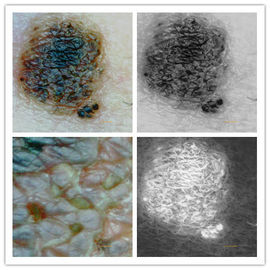 دوربین پوست و پوست سر آنالایزر دیجیتال میکروسکوپ بازرس پوست با وضوح پیکسل 5M