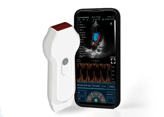 اسکنر سونوگرافی شخصی خطی + پروب قلب 2.2 مگاهرتز موبایل با فرمت DICOM