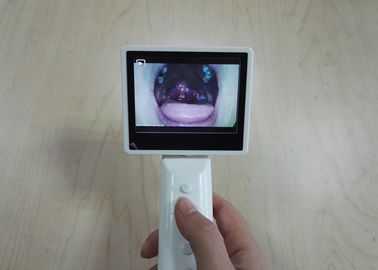 تجهیزات ذخیره سازی SD کارت تجهیزات تشخیصی Ottoscope Ophthalmoscope به صورت خودکار با کابل USB