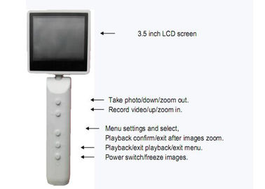 دوربین فیلمبرداری دستی دوربین تشخیصی Ottoscope دیجیتال با خروجی USB اختیاری WIFI اتصال