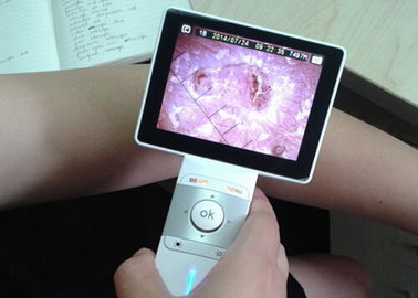 دستگاه کارت بازرگانی دیجیتال میکرو SD کارت لنز کلی تصویربرداری برای بازرسی گلو