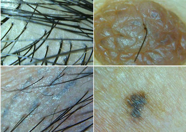 میکروسکوپ بی سیم Dermatoscope دیجیتال به کامپیوتر برای بازرسی پوست و مو