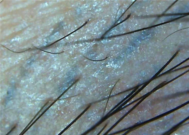 میکروسکوپ پوست ذرهبین 1000x Dermatoscope ویدئو دیجیتال برای میکروسکوپ کامل بازرسی پزشکی