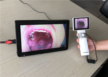 Ottoscope Otoscope قابل حمل دوربین درماتوسکوپ دوربین فیلمبرداری با خروجی کارت SD برای درمانگاه