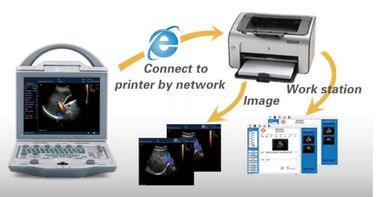 دستگاه داپلر کامل دیجیتال رنگی 2D اسکنر تشخیصی سونوگرافی