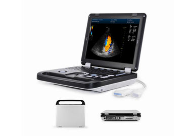 High Quality 2D Full Digital Color Doppler Machine For Pregnancy Test With Convex Probe