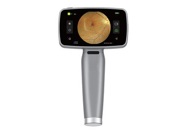 تجهیزات چشم پزشکی دوربین قابل حمل دیجیتال HFC