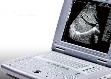 دستگاه سونوگرافی قابل حمل برای بارداری اسکنر اولتراسوند قابل حمل فقط وزن 2.2 کیلوگرم