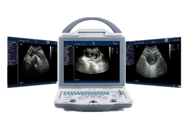 دستگاه سونوگرافی قابل حمل دستگاه سونوگرافی بیمارستان با اتصالات دو پروب