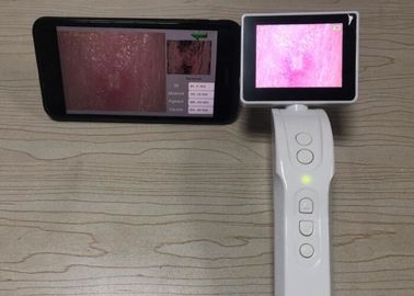Dermatoscope Digital Video Dermatoscope اتصال وای فای به صفحه نمایش 3.5 اینچ Mobilphone