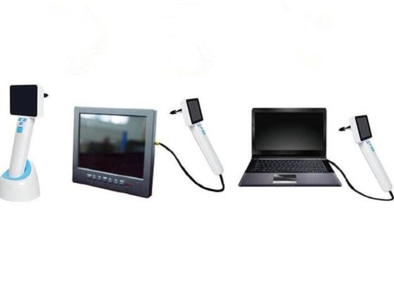 4 اتوسکوپ اتوسکوپ USB ویدئویی طبی سفید LED با تصویر ذخیره شده در قطر رایانه 0.5 سانتی متر لنز