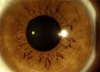 تجهیزات چشم پزشکی قابل حمل دیجیتال غیر میدریاتیک
