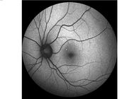 تجهیزات چشم پزشکی 160 درجه آنژیوگرافی رتینا