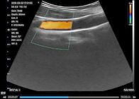 دیجیتال بی سیم دستی سونوگرافی اسکنر Wifi اتصال قلبی خطی محدب 3 در 1 شارژ بی سیم 6 زبان