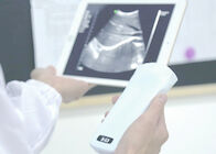 اسکنر سونوگرافی داپلر رنگی بارداری Wifi با اندازه گیری Ob / Gyn