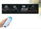 اسکنر قابل حمل مثانه دستی پروب میکرو محدب سونوگرافی دامپزشکی بارداری