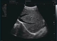 سونوگرافی داپلر در بارداری فرکانس پروب سونوگرافی داپلر خانگی 12 مگاهرتز
