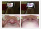 دستگاه کارت بازرگانی دیجیتال میکرو SD کارت لنز کلی تصویربرداری برای بازرسی گلو