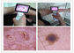 لنز بالینی ENT بازرسی از بدن بدن دیجیتال ویدئو اوتوسکوپ با رنگ TFT LCD USB Otoscope