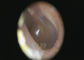 آندوسکوپ ENT بازپخش دیجیتال ویدئو عتوسکوپ با خروجی SD کارت Otoscope USB