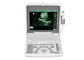 ال سی دی قابل حمل لپ تاپ سونوگرافی اسکنر تجهیزات پزشکی BIO 3000J با 1.12 اینچ صفحه نمایش LED