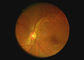 آندوسکوپ دیجیتال دوربین دیجیتال دوربین بصری تجهیزات نوری چشمی با 2 میلیون پیکسل