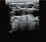 تجهیزات اسکنر سونوگرافی دستی تشخیصی بی سیم با 8 تنظیم TGC