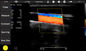 اسکنر سونوگرافی دستی Ultrasound Tranducer سازگار با Windows / Android / IOS