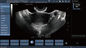 اسکنر اولتراسوند رنگی داپلر Probe Mobile Color Transvaginal برای بارداری