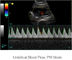 اسکنر سونوگرافی قابل حمل سیستم داپلر رنگی با مانیتور LED 12.1 اینچ و 2 پورت پروب