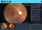 نرم افزار گزارش موجود چشم پزشکی دوربین Fundus دوربین از راه دور پزشکی چشم باتری لیتیوم قابل شارژ
