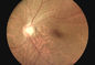 وزن چشم قابل حمل چشم پزشکی دوربین دیجیتال فودوس دستی FOV 45 درجه فای از راه دور پزشکی پزشکی اختیاری