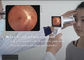 دوربین عکاسی دیجیتال Fundus قابل حمل Opthalmic قابل حمل با لنز تله مدیسین با کیفیت بالا 1080P