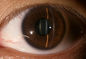 3.5 اینچ صفحه لمسی پزشکی چشم پزشکی دیجیتال دوربین Fundus دوربین ضمیمه نمای جلویی موجود است