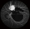 دوربین دیجیتال Fundus Opthalmoscope مدل Confocal Retina با FOV 15 درجه ، 30 درجه ، 60 درجه اندازه تصویر 1024 * 1024