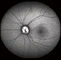 دوربین دیجیتال Fundus Opthalmoscope مدل Confocal Retina با FOV 15 درجه ، 30 درجه ، 60 درجه اندازه تصویر 1024 * 1024