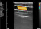 دستگاه سونوگرافی رنگی اسکنر اولتراسوند خانگی سونوگرافی قابل حمل برای بارداری 8 TGC 3.5 ~ 10 مگاهرتز