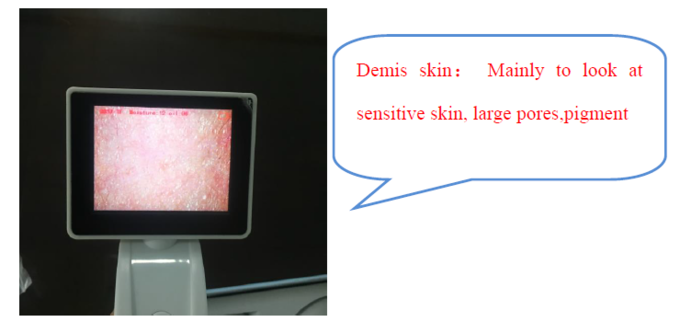 آنالایزر پوست دیجیتال CE BS5SH رطوبت سنج دیجیتال پوست برای دکتر