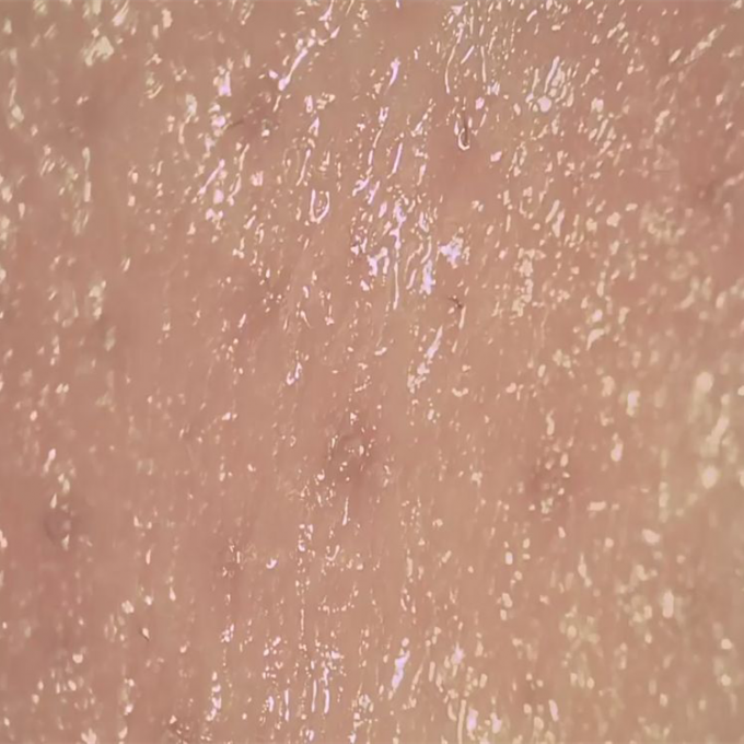آنالایزر دیجیتال بی سیم و رطوبت پوست برای مشاهده سطح پوسته های پوستی