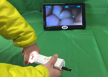 X 1.5 Magnification کولپوسکوپ الکترونیک دیجیتال به تلویزیون یا رایانه یا مانیتور پزشکی برای سلامت زنان متصل است