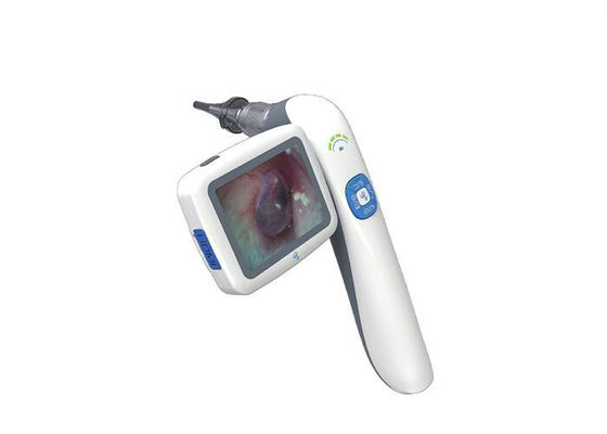 اتوسکوپ تصویری دیجیتال دستی دستی گوش و حلق و بینی قابل حمل با فلش کارت Micro SD 32G