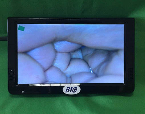 کولپوسکوپ الکترونیک دیجیتال قابل حمل