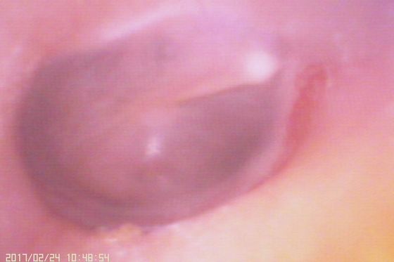 اتوسکوپ ویدیویی دیجیتال 720X480