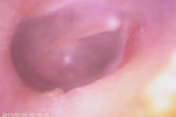 اتوسکوپ ویدیویی دیجیتال 720X480