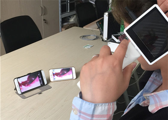 اتوسکوپ ویدیویی دیجیتال 720X480