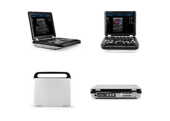 اسکنر التراسونوگرافی انسانی با 15 دی وی دی با اتصال یک پروب و دو پورت USB