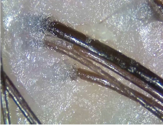 دستگاه قابل تشخیص از راه دور پزشکی آنالایزر بی سیم و قابل حمل با استفاده از نور قطبی