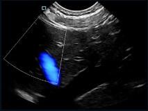 مأمور اسکنر سونوگرافی دستی Mini Pocket قابل تغییر با فرکانس 2 ~ 11MHz