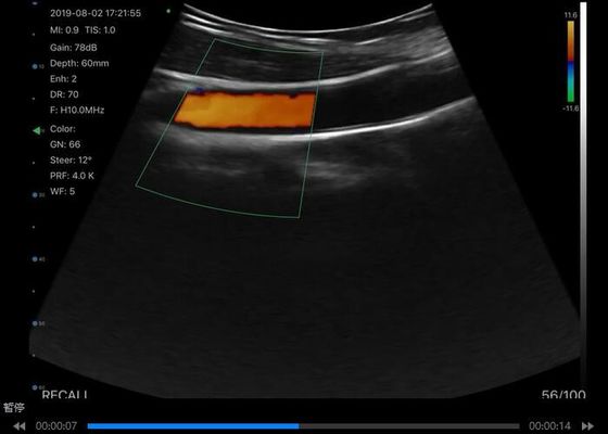 اسکنر اولتراسوند دستی بی‌سیم دیجیتال