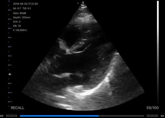 اسکنر اولتراسوند دستی بی‌سیم دیجیتال